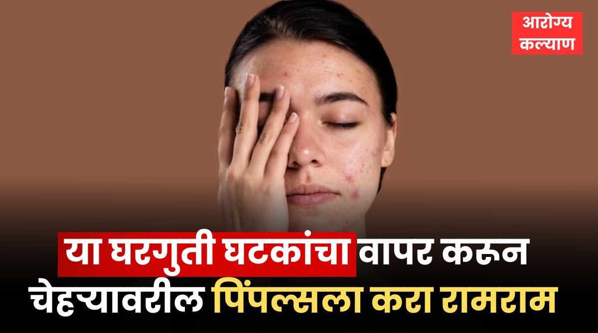 Pimples Home Remedies In Marathi